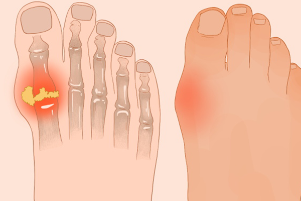 �ߵ��׵�ʳ�ﲻ�ʺ���Щ��Ⱥ �ߵ��׵�ʳ������Щ